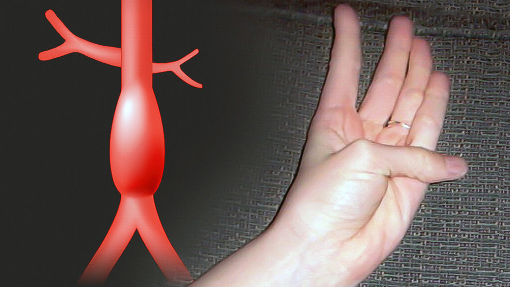 Moviendo un sólo dedo podrás saber si sufres del corazón (Foto)